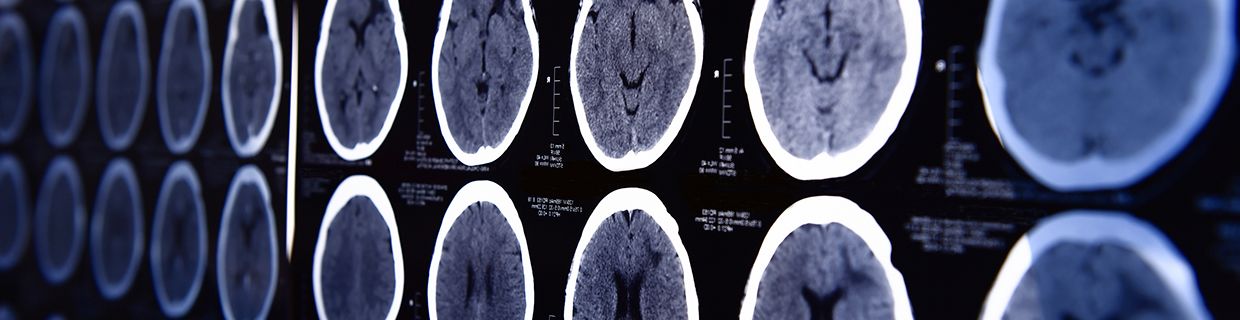 Image of brain scans